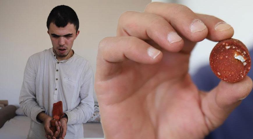 Görme engelli genç ölümden döndü! Sucuğun içinden çıkan şoke etti