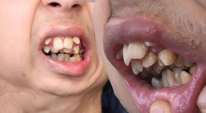 Alt çenesi yok, dişleri üst damağında! Özel mamalarla besleniyor