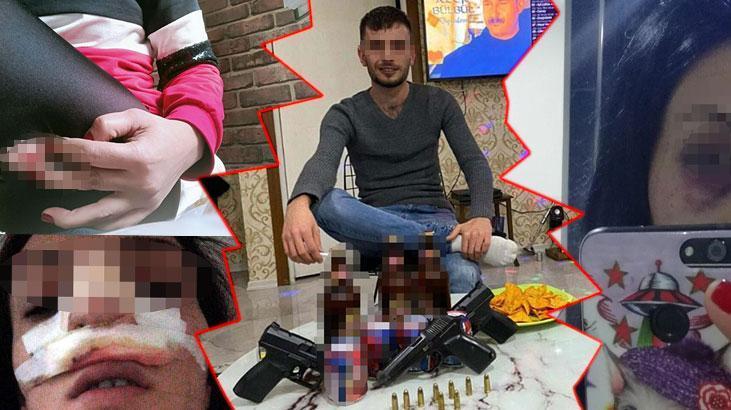 Eşini bıçaklayan kocaya ödül gibi ceza: Bu karardan dolayı üzgünüm