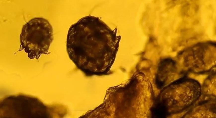 Gece kaşıntılarına dikkat! Temas ile bulaşıyor, vaka sayısı her geçen gün artıyor