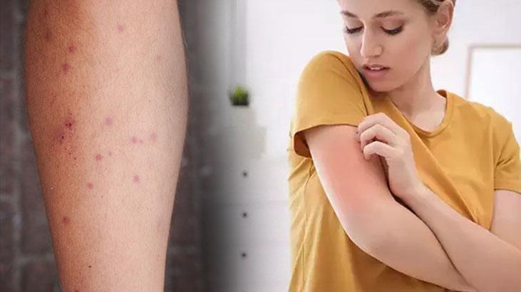 30 kat hızla yayılıyor! Herkes her an yakalanabilir