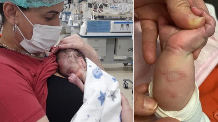 Gebze’de kan donduran iddia! Dördüz bebekler kuvözde yandı, mikrop kaparak üçü öldü