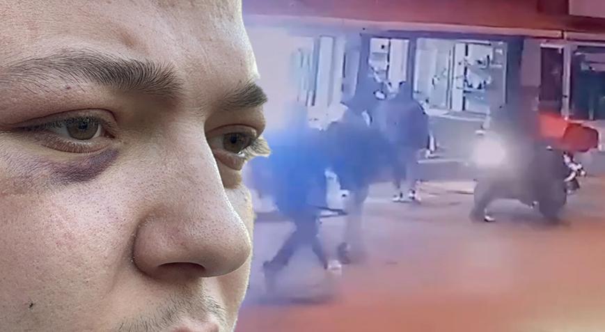 Motokuryeye dehşeti yaşattılar! ‘Ellerinde bıçaklarla üzerime çullandılar’