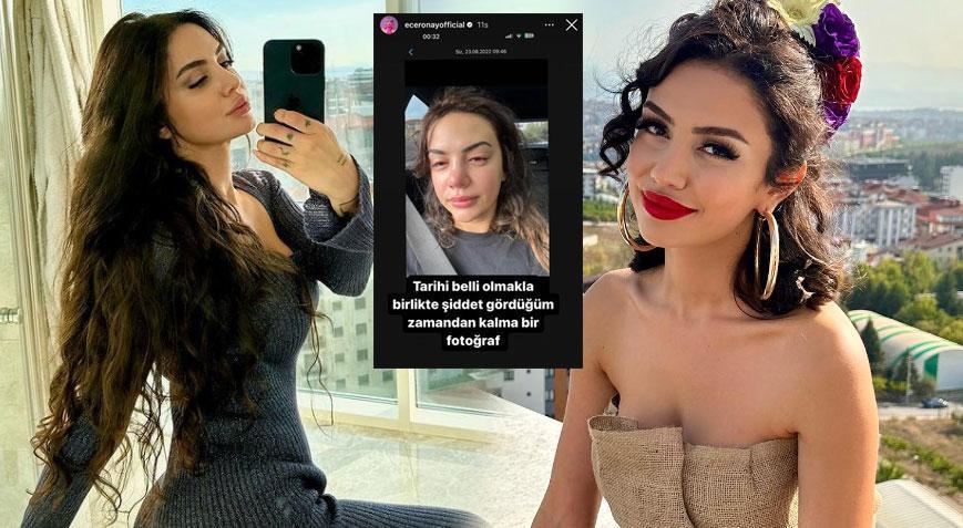 Sular Durulmuyor! Ece Ronay’ın eski eşine hapis şoku