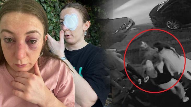 Kabus cinsel içerikli mesajlarla başladı: Vücudumda defalarca sigara söndürdü