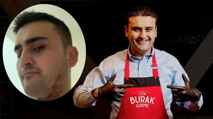 CZN Burak yaralı hallerini paylaşınca takipçilerini korkuttu!