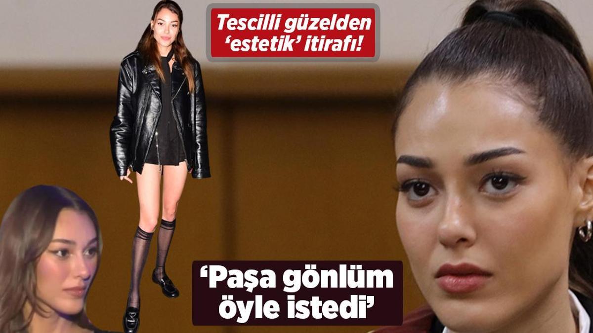 Dilan Çiçek Deniz’den ‘estetik’ itirafı! ‘Paşa gönlüm o an öyle istedi’