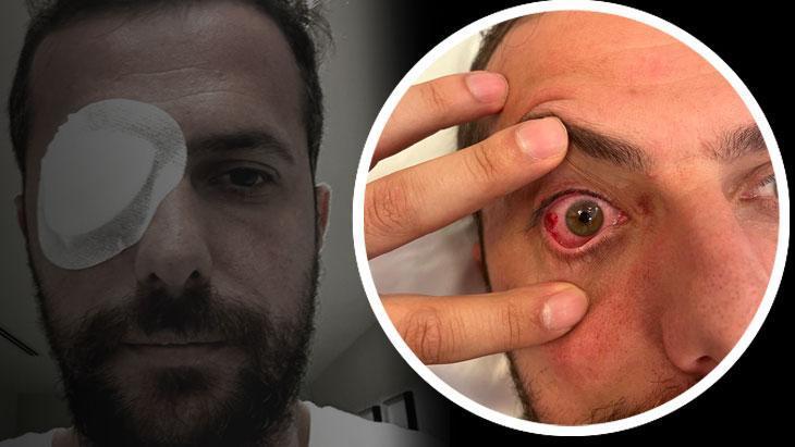 Eyüpsporlu Uğur Demirok canlı yayında isyan etti! ‘Resmen öldürmeye teşebbüs’