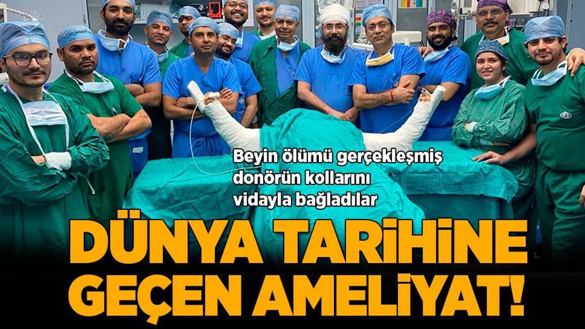Dünya tarihine geçen ameliyat! Beyin ölümü gerçekleşmiş kadının kollarını erkeğe ‘vidaladılar’