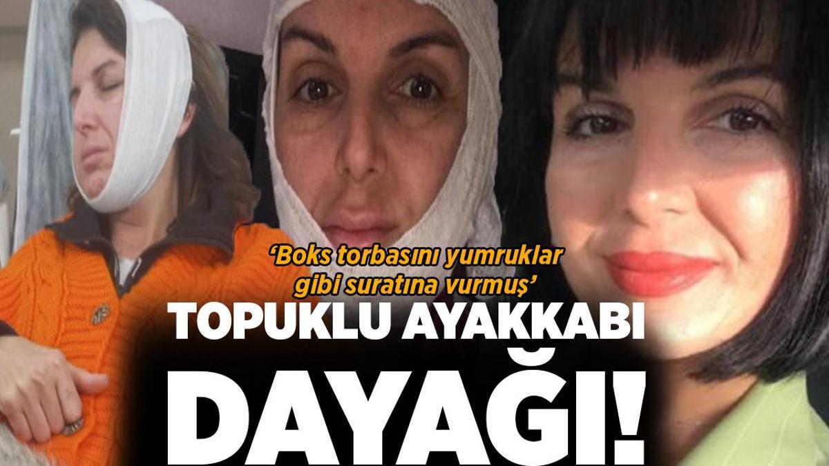 Güzellik salonunda topuklu ayakkabı dayağı! ‘Boks torbasını yumruklar gibi suratına vurmuş’
