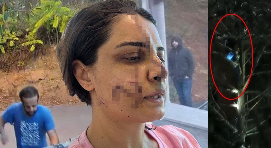 ’40 dikişli’ dehşette korkunç detaylar: Ağaca tırmanıp saklandı, taksiyle kapısına dayandı
