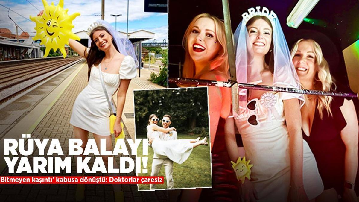 Rüya balayı yarım kaldı, ‘bitmeyen kaşıntı’ kabusa dönüştü! Doktorlar çaresiz