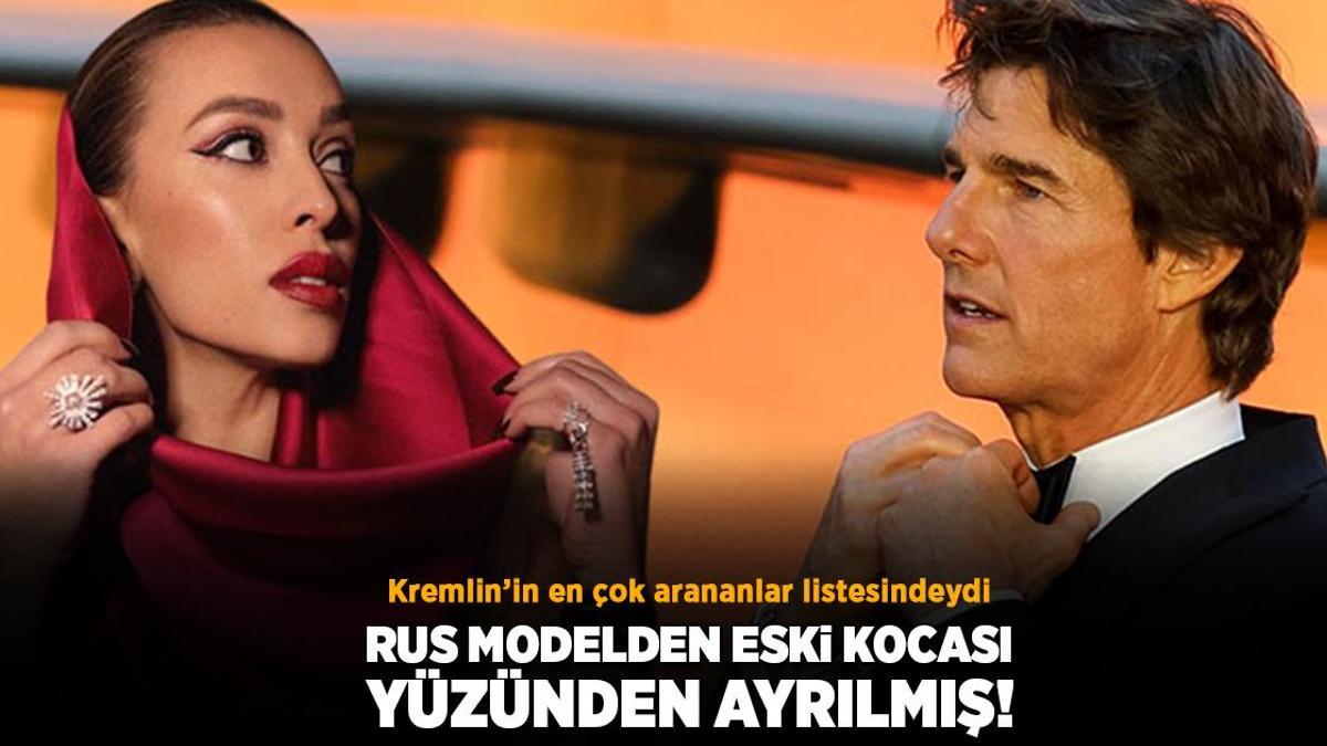 Rus modelden eski kocası yüzünden ayrılmış! ‘Ekibi endişelendi, risk almak istemediler’