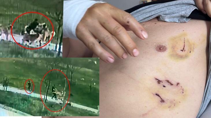 Oğlu için kendini feda etti, köpek sürüsünün arasında kaldı! Çenesi kırıldı, elleri parçalandı
