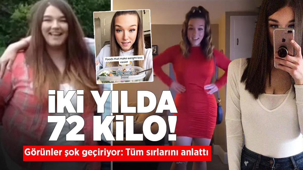 İki yılda 72 kilo verdi! Görünler şok geçiriyor: Tüm sırlarını anlattı