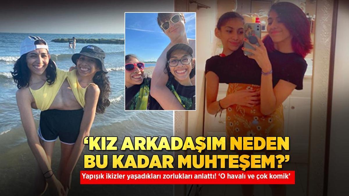 ‘Sevgilim neden bu kadar muhteşem?’ Yapışık ikizler yaşadıkları zorlukları anlattı! ‘O havalı ve çok komik’