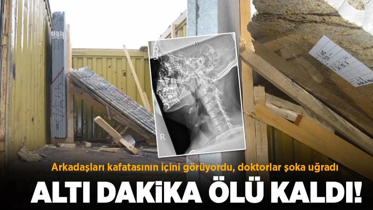 Yerinden fırlayan gözlerle altı dakika ölü kaldı, arkadaşları kafatasının içini görüyordu! Yüzde 2 şans verilen savaşı kazandı