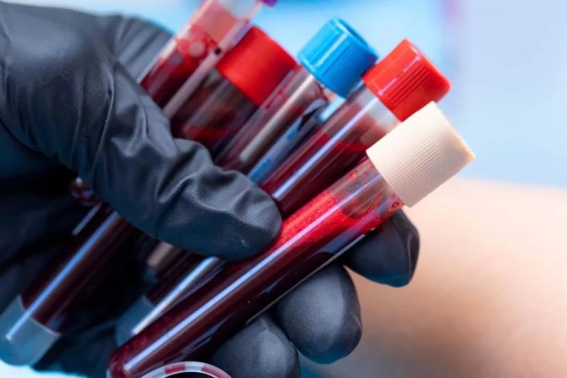 Araştırmalar ortaya koydu: Bu kan grubuna sahip kişiler yaşlanmıyor