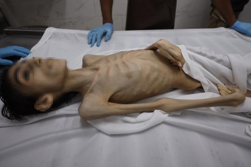 Gazze’de son 24 saatte 7 kişi açlıktan yaşamını yitirdi