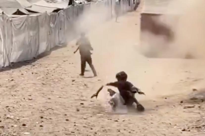 Gazzeli çocuk, İsrail’in hava saldırısında şarapnel parçasıyla yaralandı: Ölümden döndü