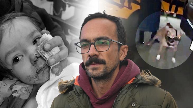 Etimesgut’ta Pitbull Saldırısı: 1,5 Yaşındaki Efe ve 5 Yaşındaki Doğa Yaralandı