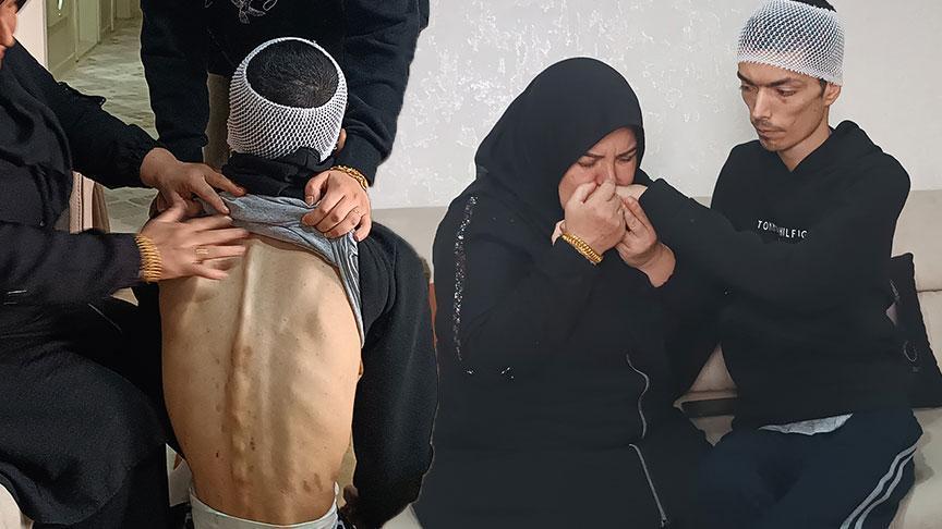 Bakım Merkezinde Şiddet İddiası Anne Şikayetçi Oldu