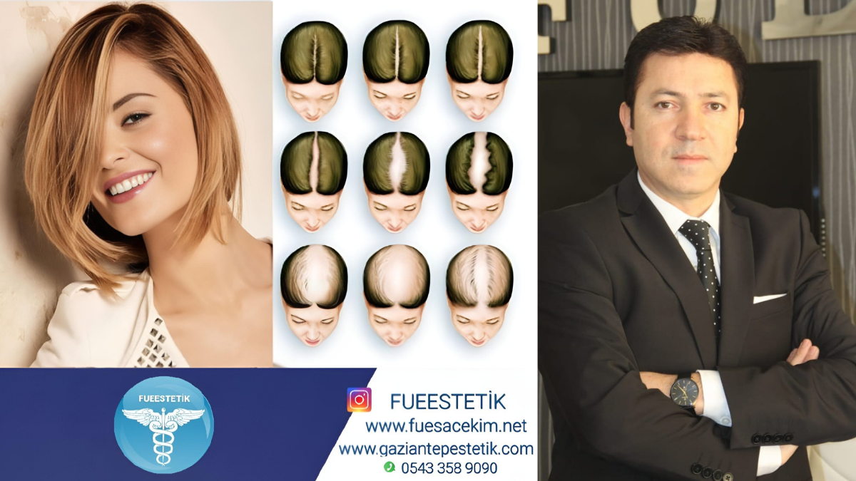 Fue Saç Ekiminde Güven ve Yenilik: Uzm. Est. Yaşar Aykan’dan Kadınlara Özel Tıraşsız Yöntem